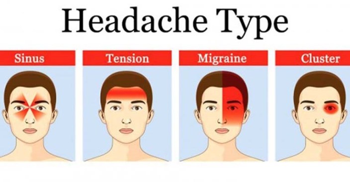 4 types of headaches